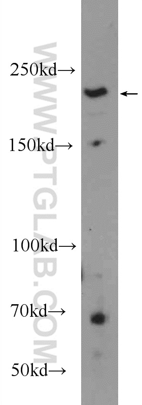 WB analysis of HeLa using 25183-1-AP