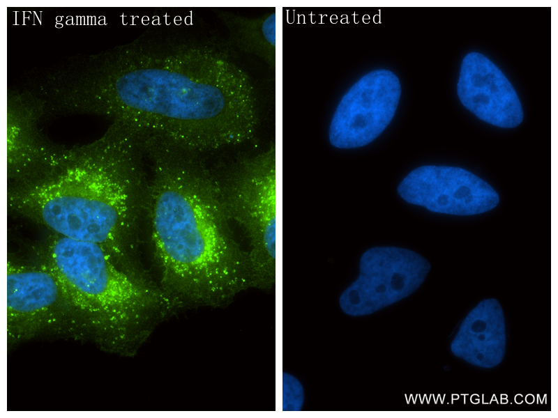 IF Staining of HeLa using 83751-6-RR