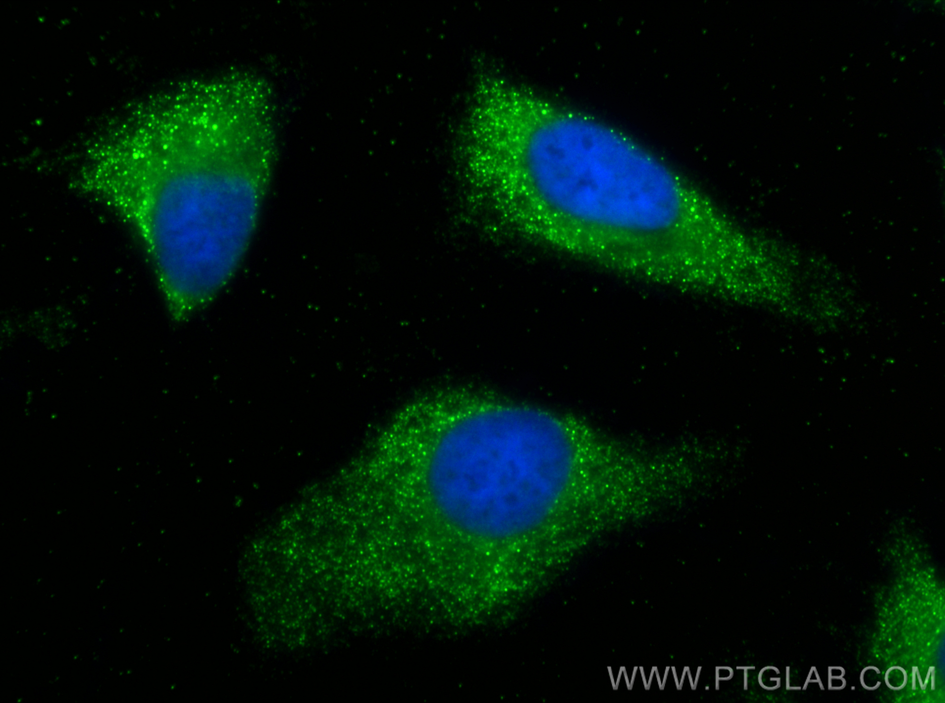 IF Staining of HeLa using 11854-1-AP