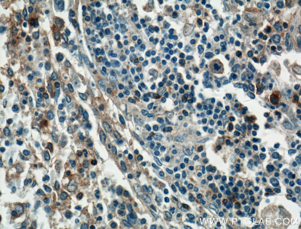 IHC staining of human spleen using 27299-1-AP