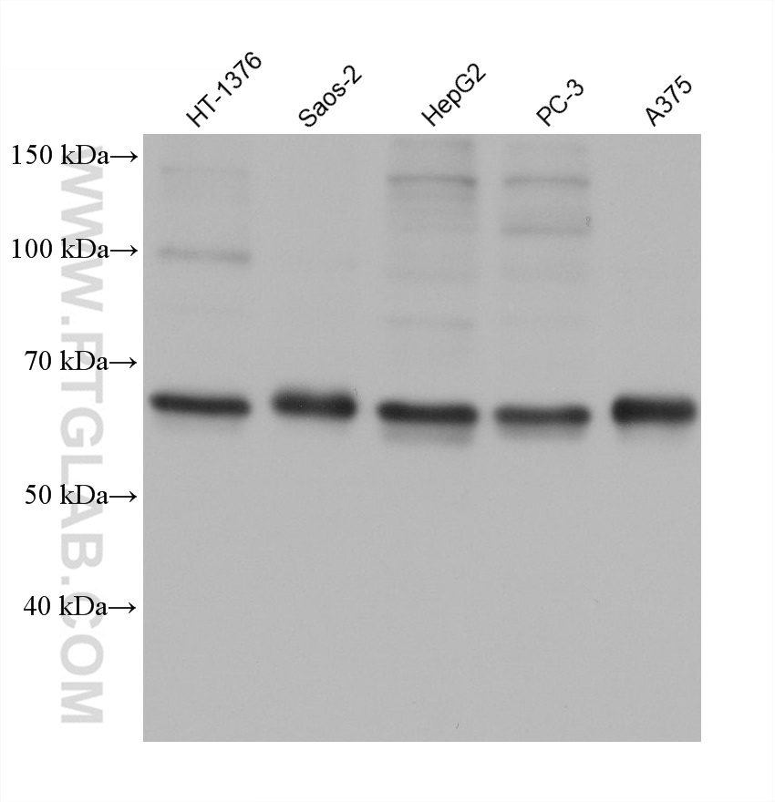 WB analysis using 68559-1-Ig