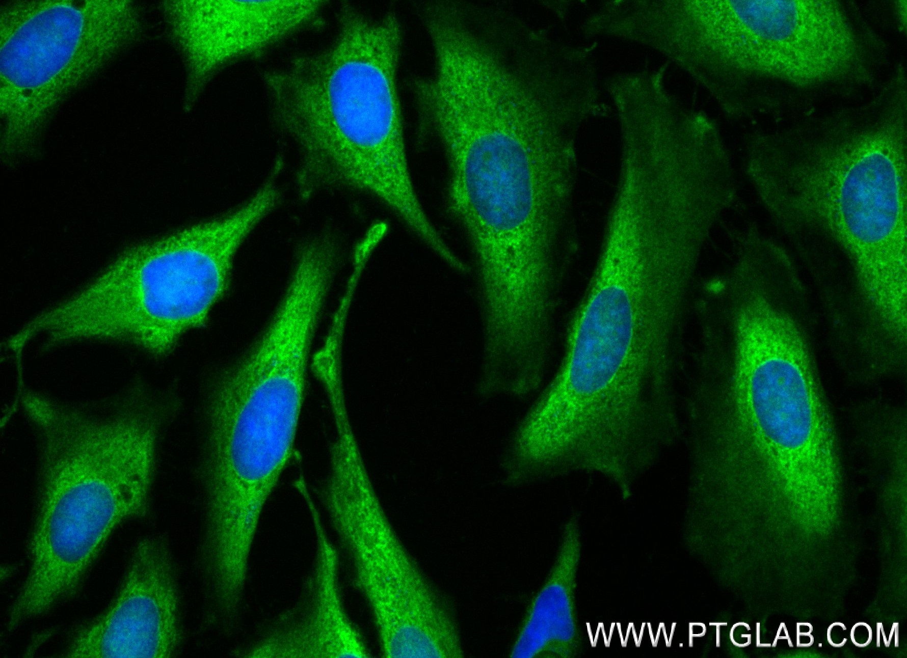 IF Staining of HeLa using 84264-6-RR (same clone as 84264-6-PBS)