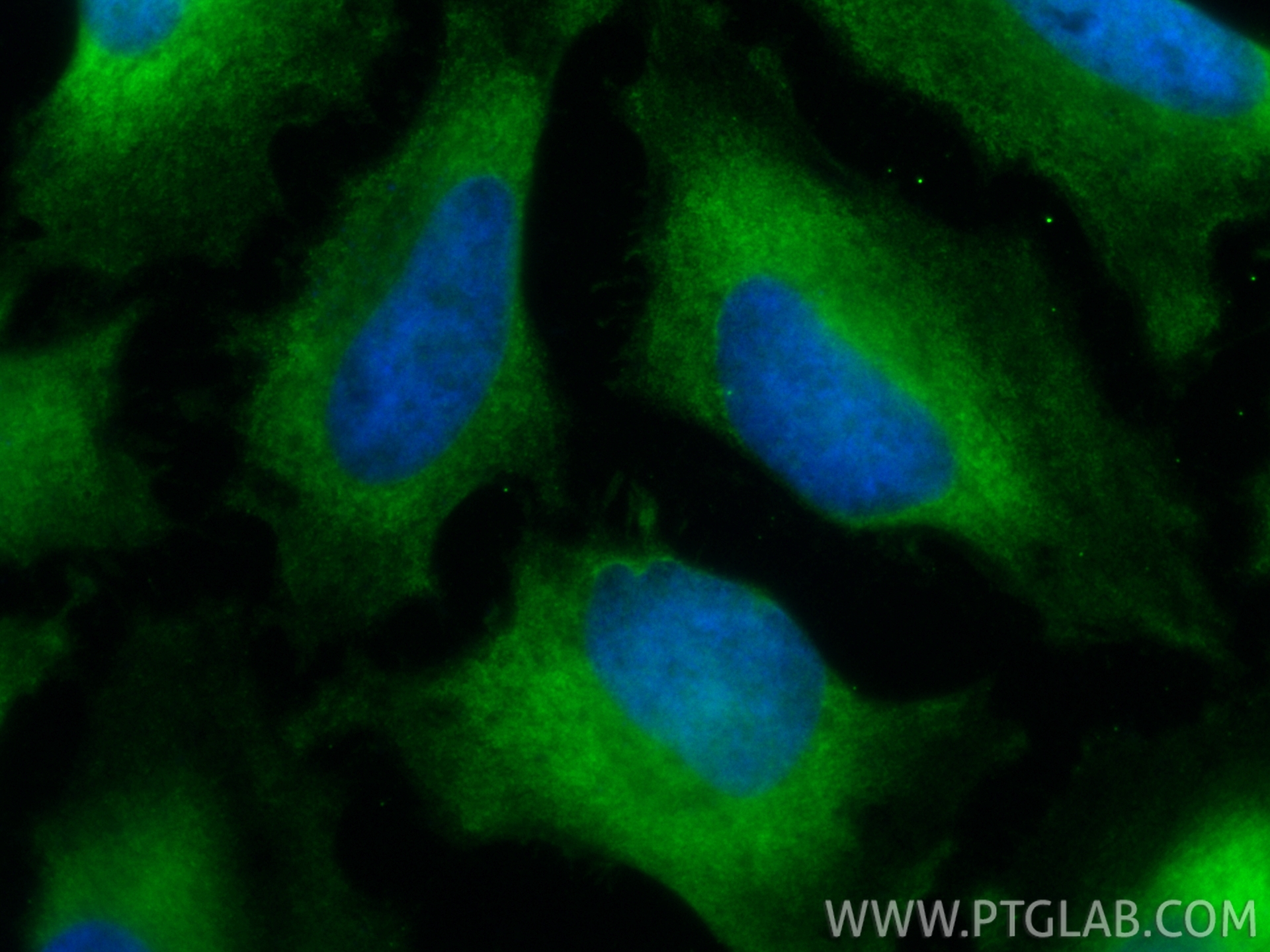 Immunofluorescent analysis of (-20°C Ethanol) fixed HeLa cells using CoraLite® Plus 488 GBP2 antibody (CL488-84264-6, Clone: 241580C12 ) at dilution of 1:100. IF Staining of HeLa using CL488-84264-6