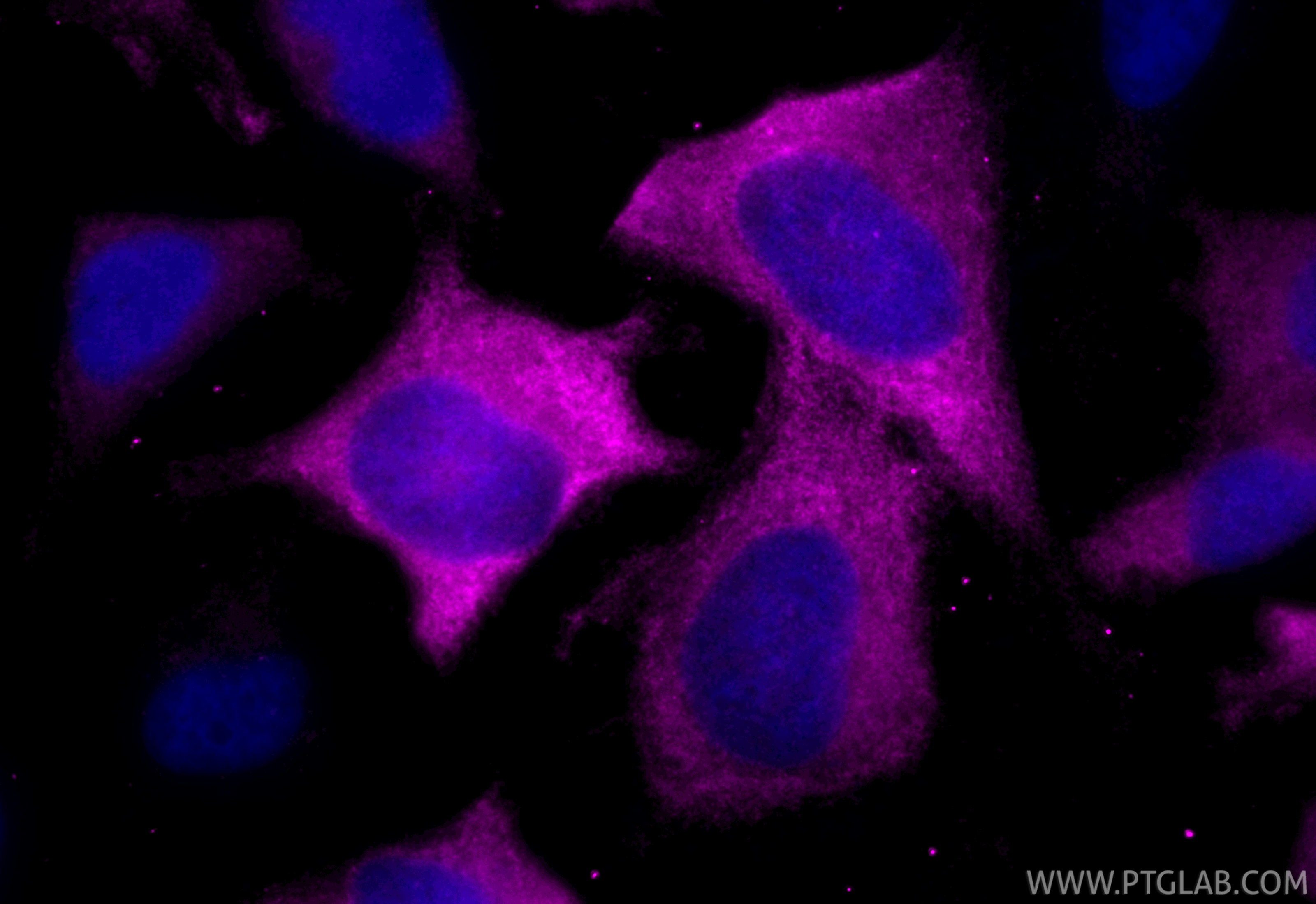 Immunofluorescent analysis of (-20°C Ethanol) fixed HeLa cells using CoraLite® Plus 647 GBP2 antibody (CL647-84264-6, Clone: 241580C12 ) at dilution of 1:200. IF Staining of HeLa using CL647-84264-6