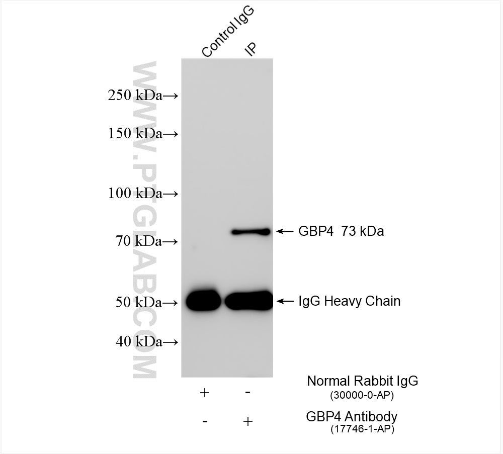IP experiment of A431 using 17746-1-AP