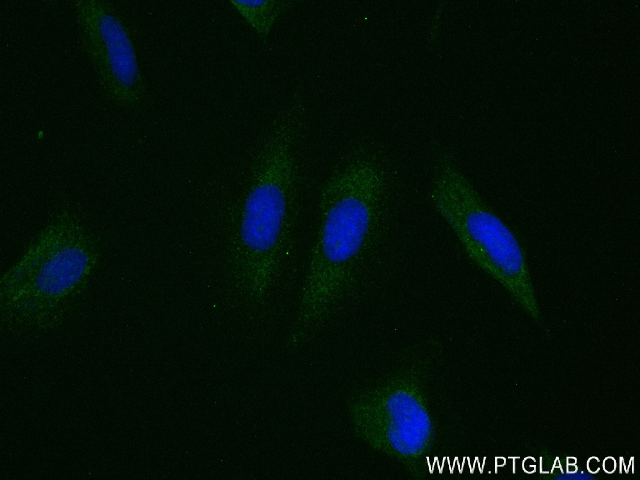 IF Staining of HeLa using 83699-2-RR