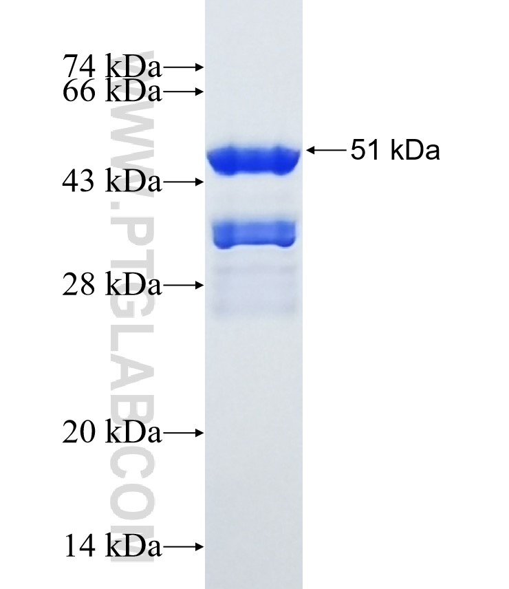 GBP5 fusion protein Ag4103 SDS-PAGE