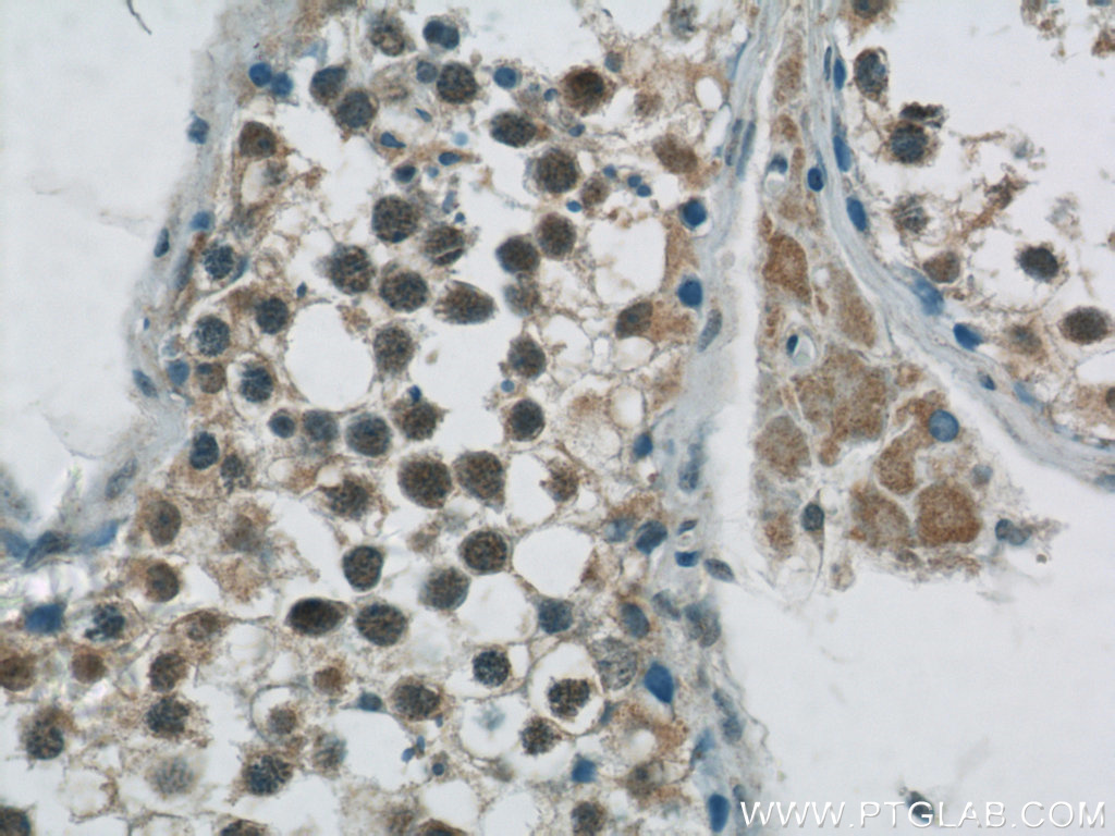 IHC staining of human testis using 23001-1-AP