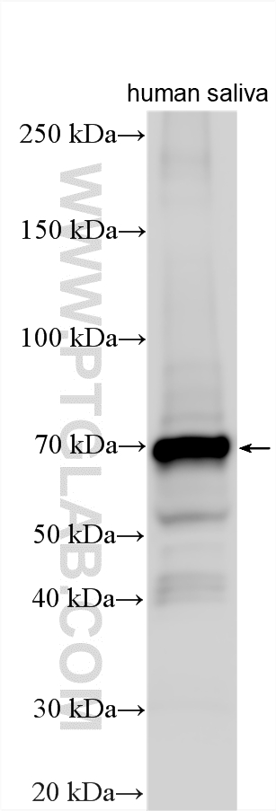 WB analysis using 23001-1-AP WB analysis using 23001-1-AP