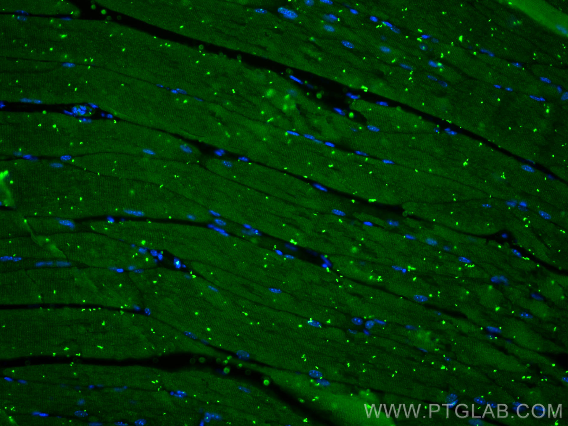 IF Staining of mouse skeletal muscle using 55035-1-AP