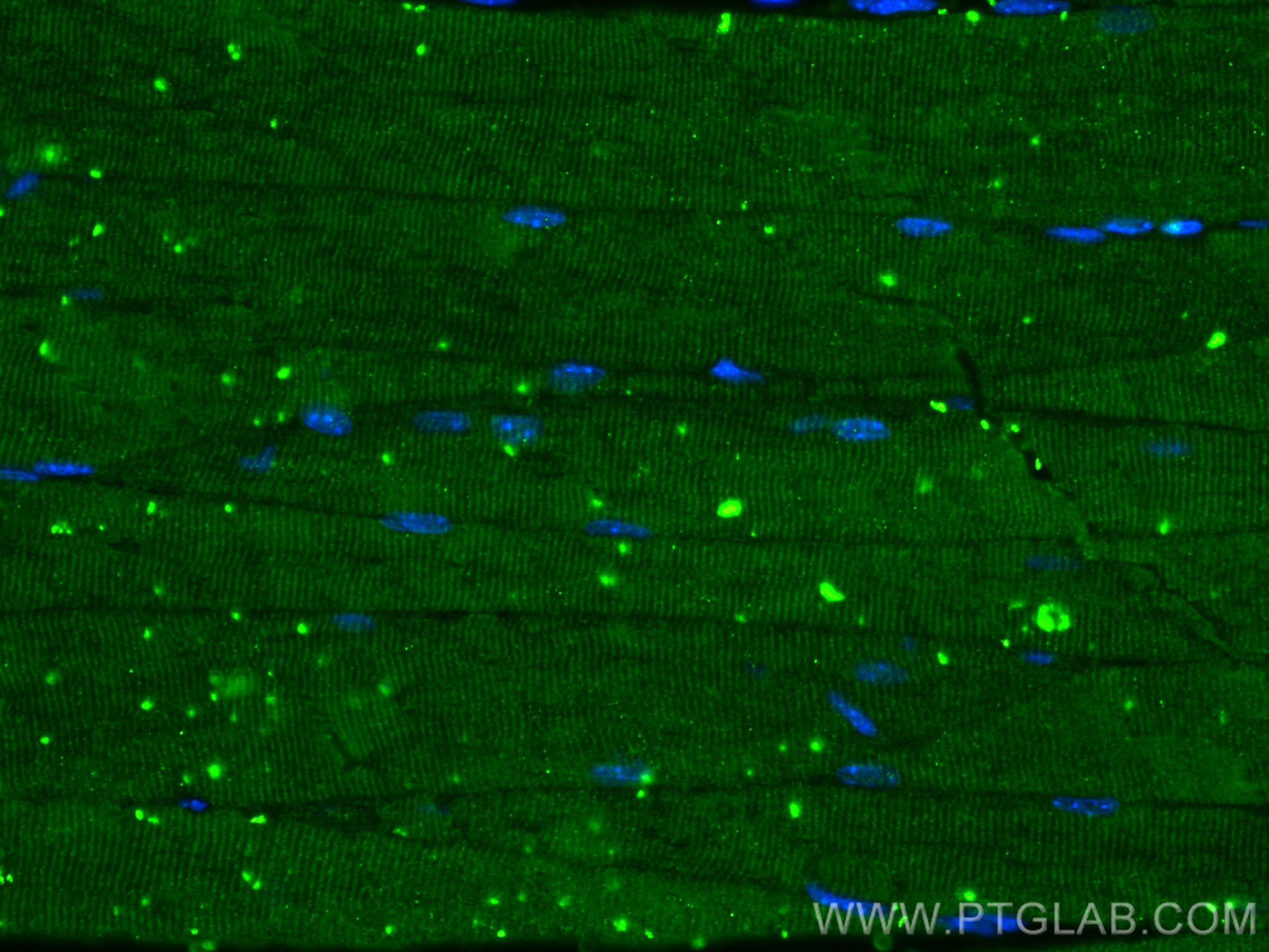 IF Staining of mouse skeletal muscle using 55035-1-AP