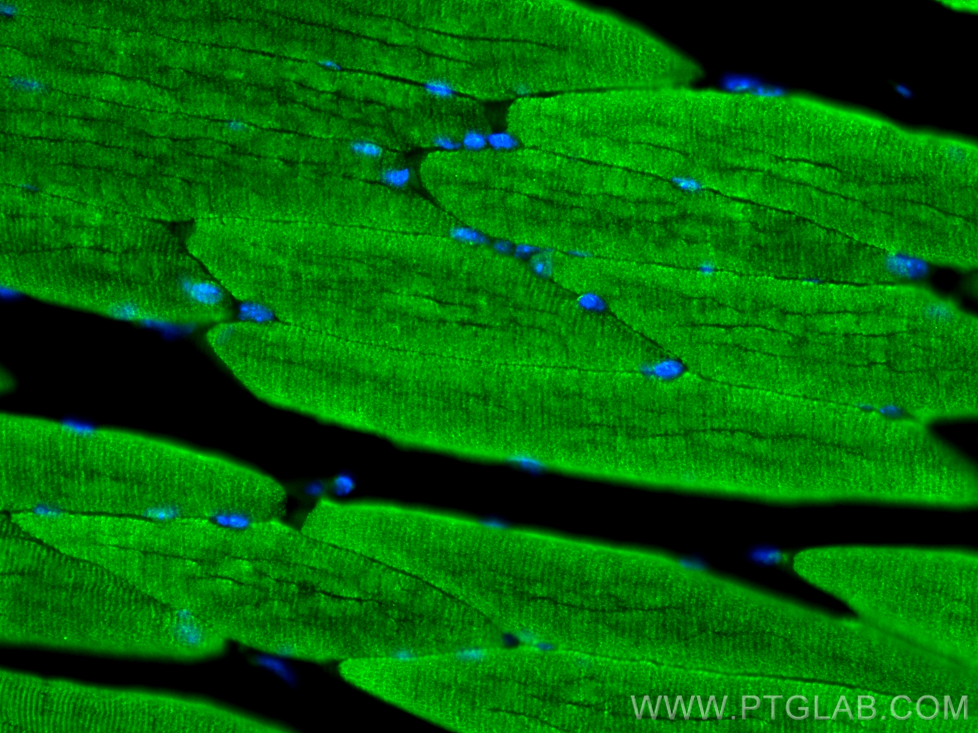 IF Staining of mouse skeletal muscle using 55035-1-AP