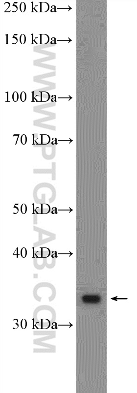 WB analysis of mouse stomach using 21639-1-AP