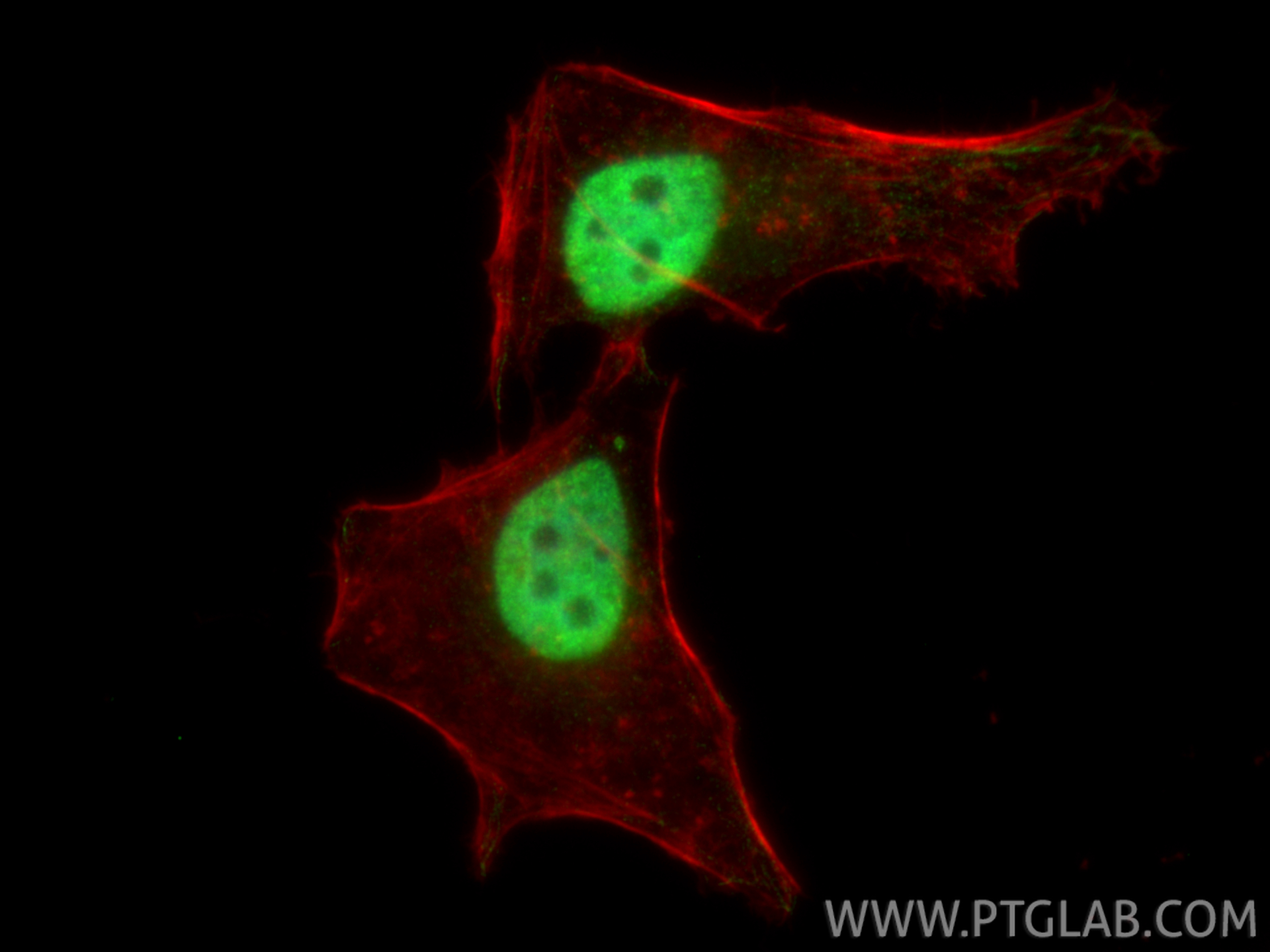 IF Staining of HeLa using 61029-1-Ig