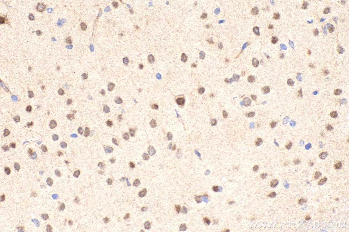 IHC staining of mouse brain using 61029-1-Ig