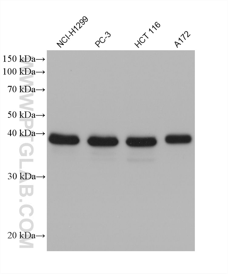WB analysis using 61029-1-Ig