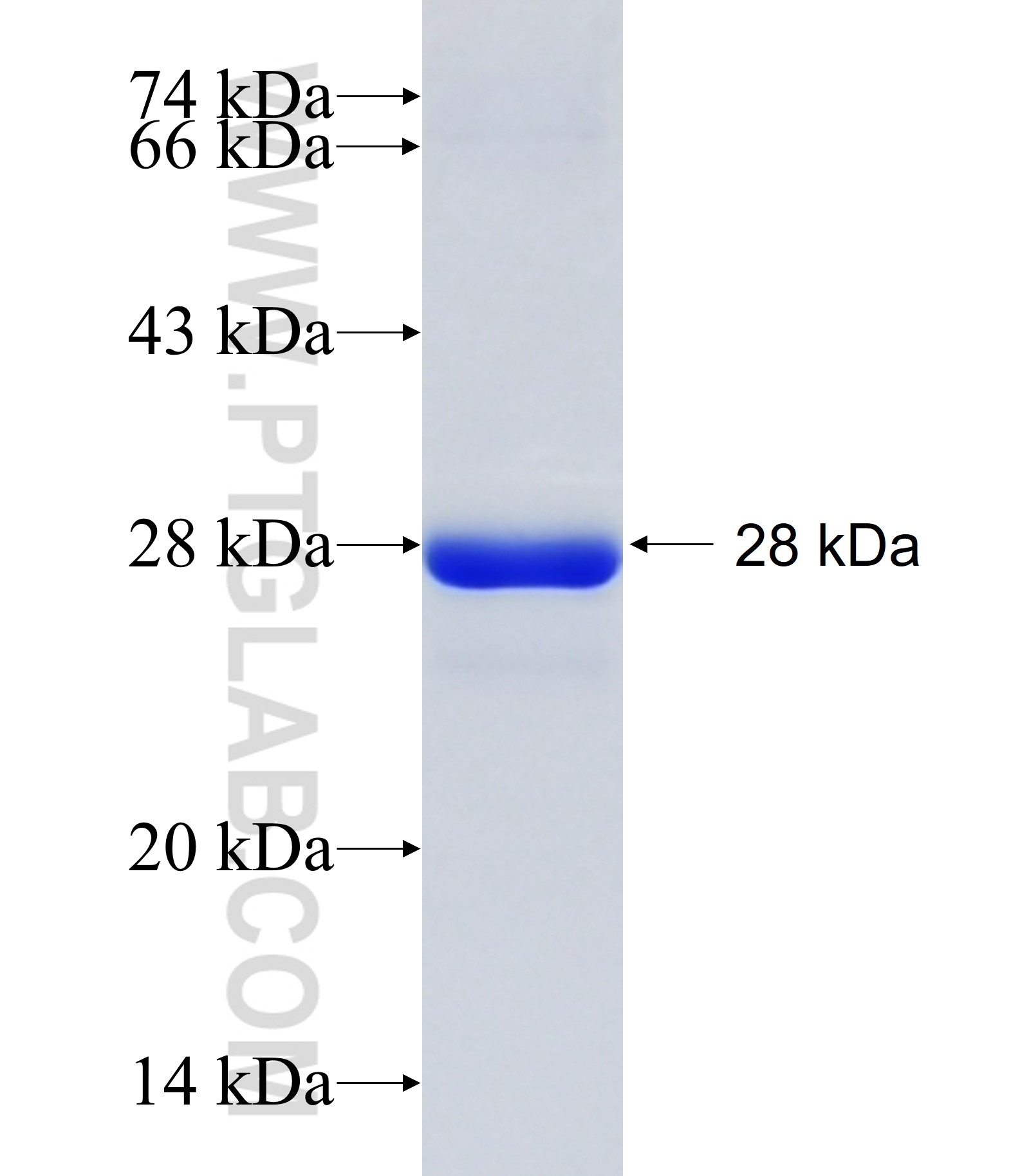GBX2 fusion protein Ag17109 SDS-PAGE GBX2 fusion protein Ag17109 SDS-PAGE