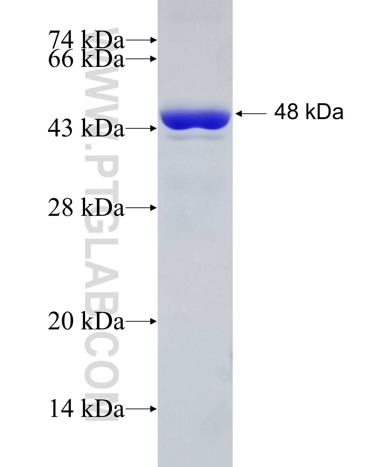 GCC1 fusion protein Ag9378 SDS-PAGE