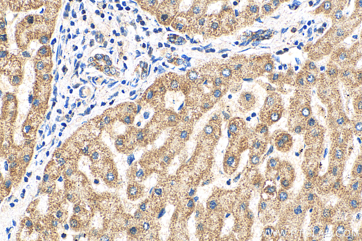 IHC staining of human liver using 14930-1-AP