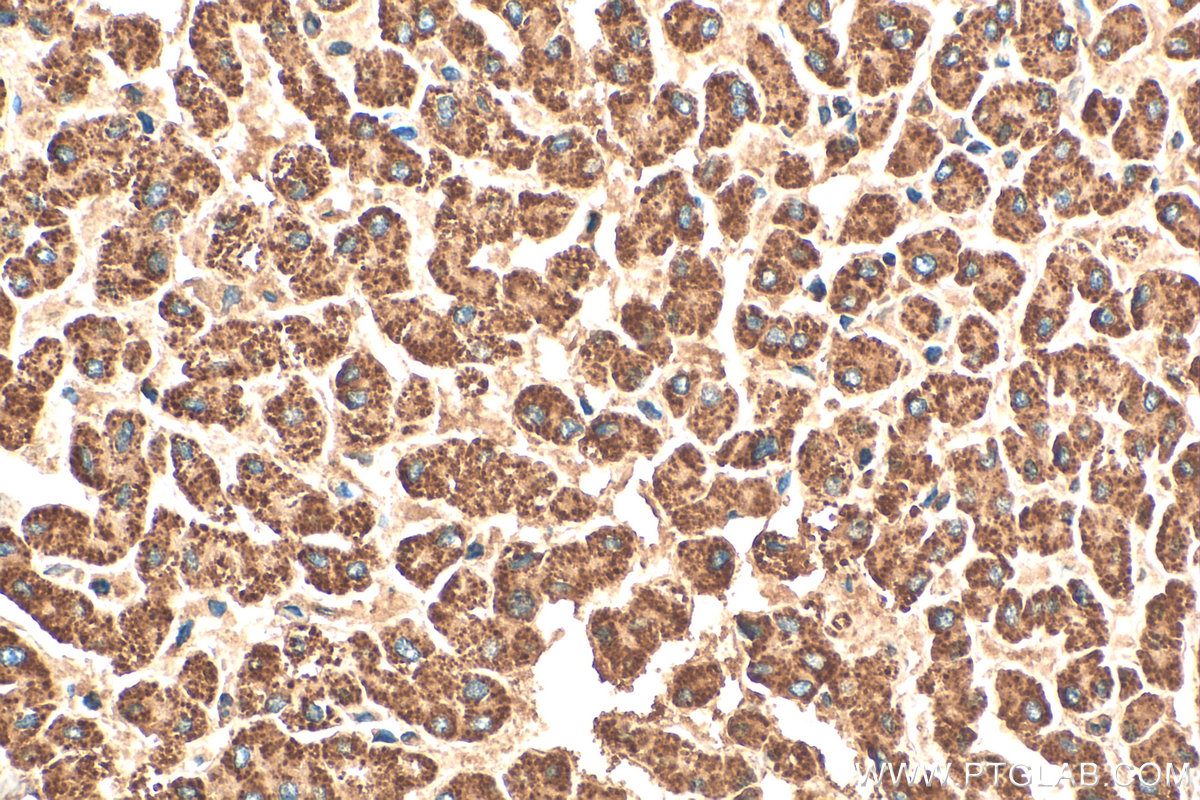 Immunohistochemical analysis of paraffin-embedded human liver tissue slide using 14930-1-AP (GCDH antibody) at dilution of 1:200 (under 40x lens). Heat mediated antigen retrieval with Tris-EDTA buffer (pH 9.0). IHC staining of human liver using 14930-1-AP