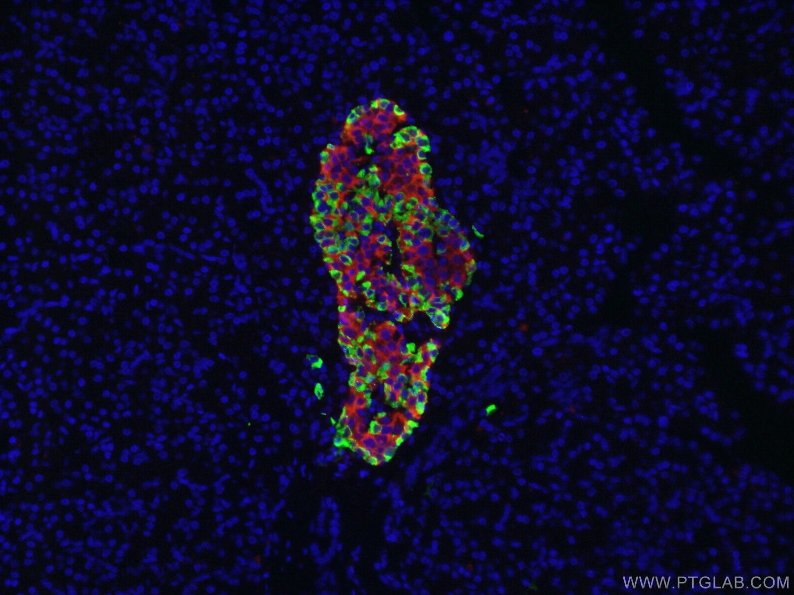 IF Staining of human pancreas using 15954-1-AP