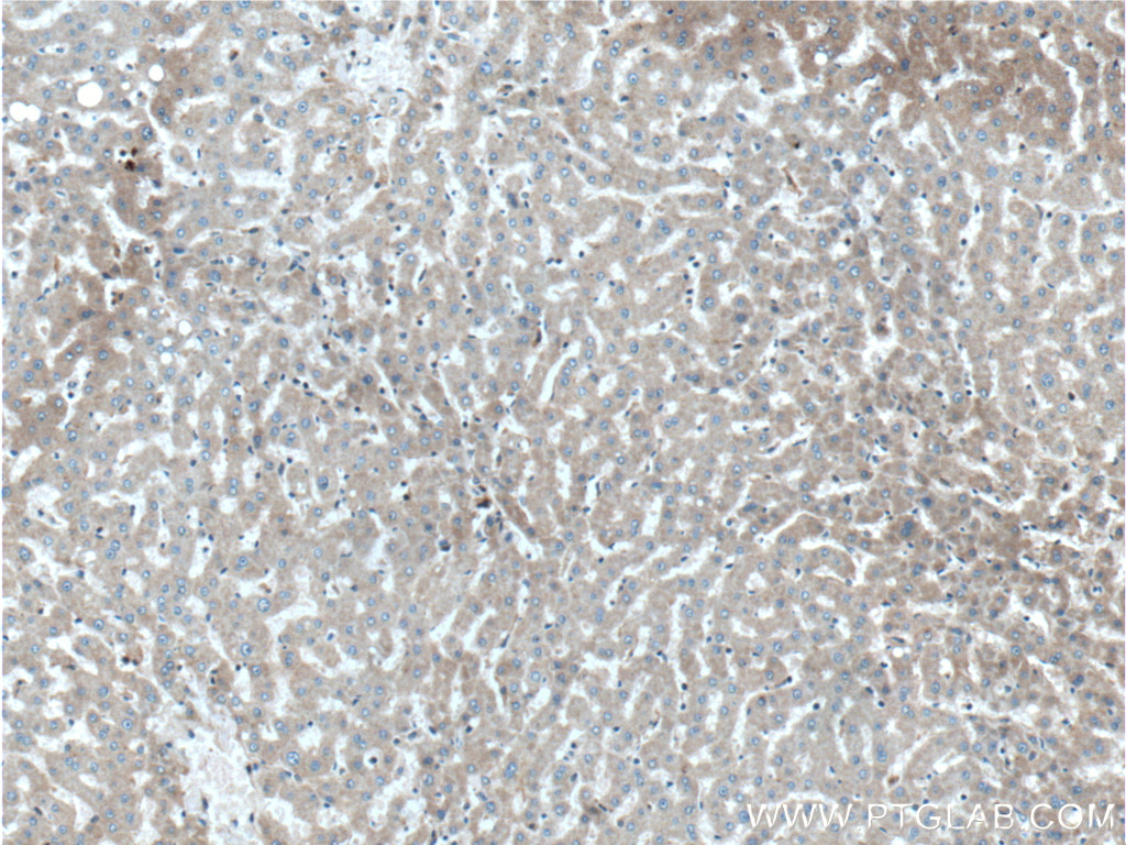 IHC staining of human liver using 26784-1-AP