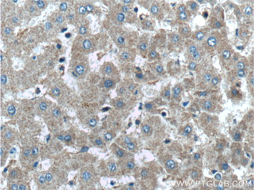 IHC staining of human liver using 26784-1-AP