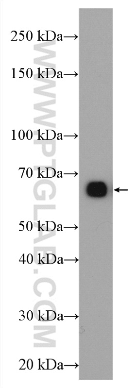 WB analysis of mouse liver using 26784-1-AP