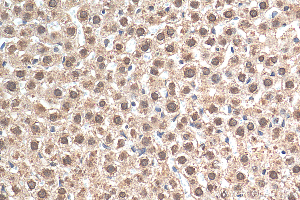 IHC staining of rat liver using 28501-1-AP