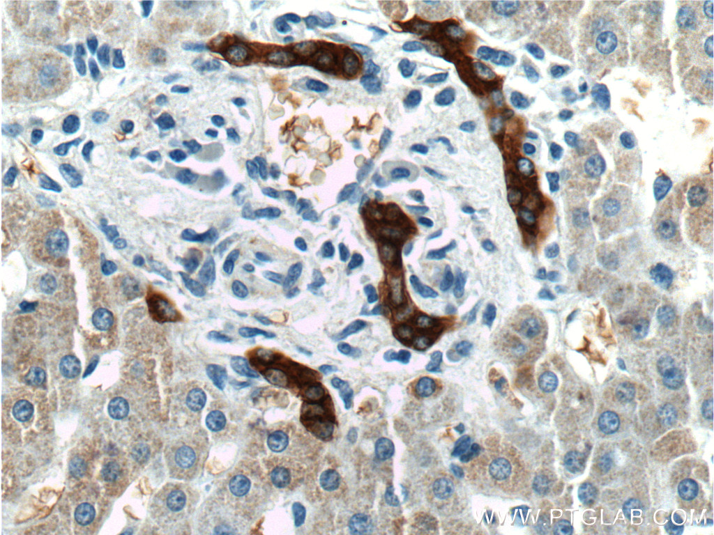 IHC staining of human liver using 19666-1-AP