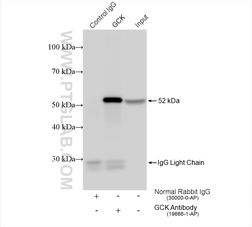 IP experiment of mouse liver using 19666-1-AP