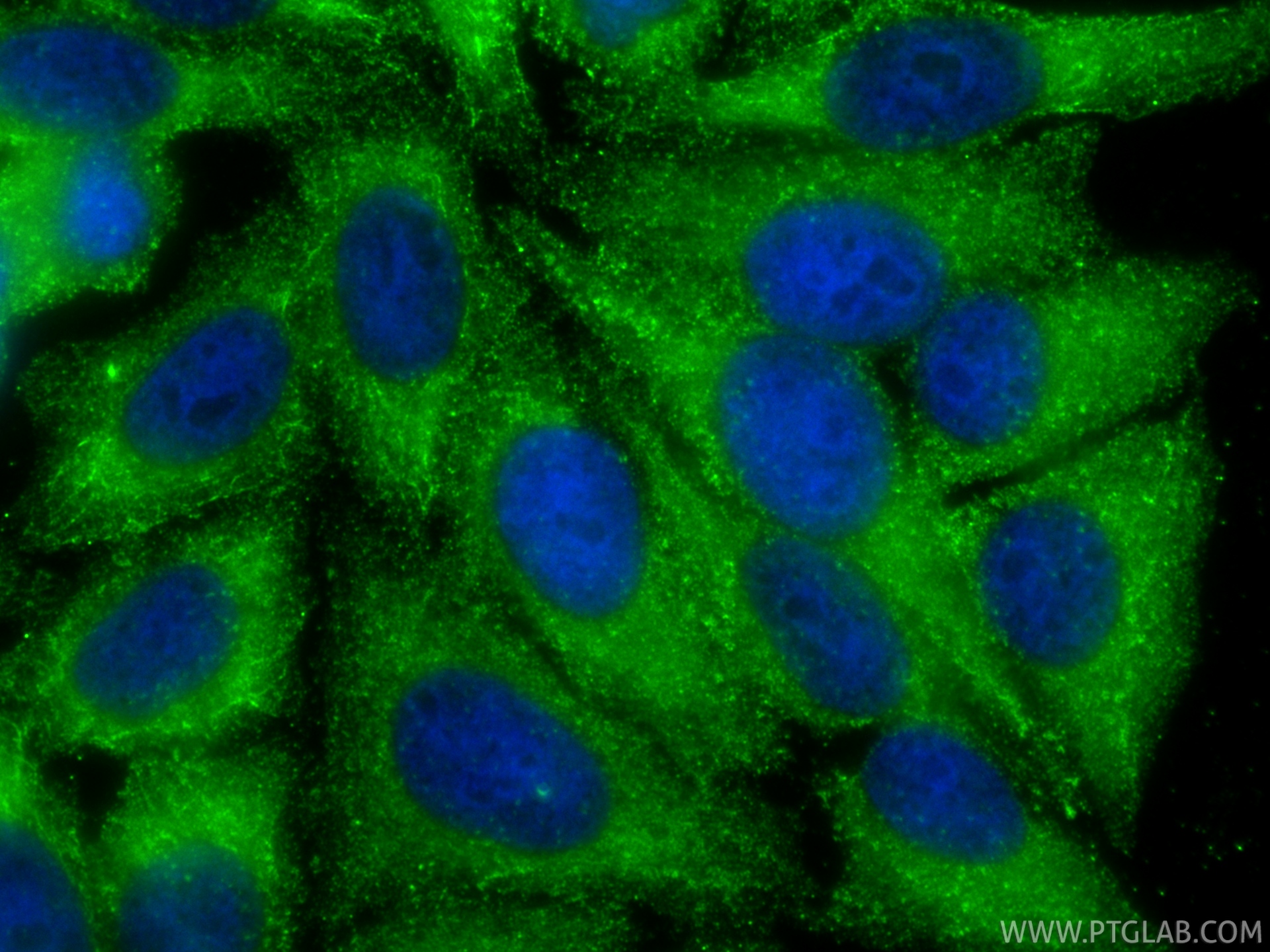 IF Staining of HepG2 using 67216-1-Ig IF Staining of HepG2 using 67216-1-Ig
