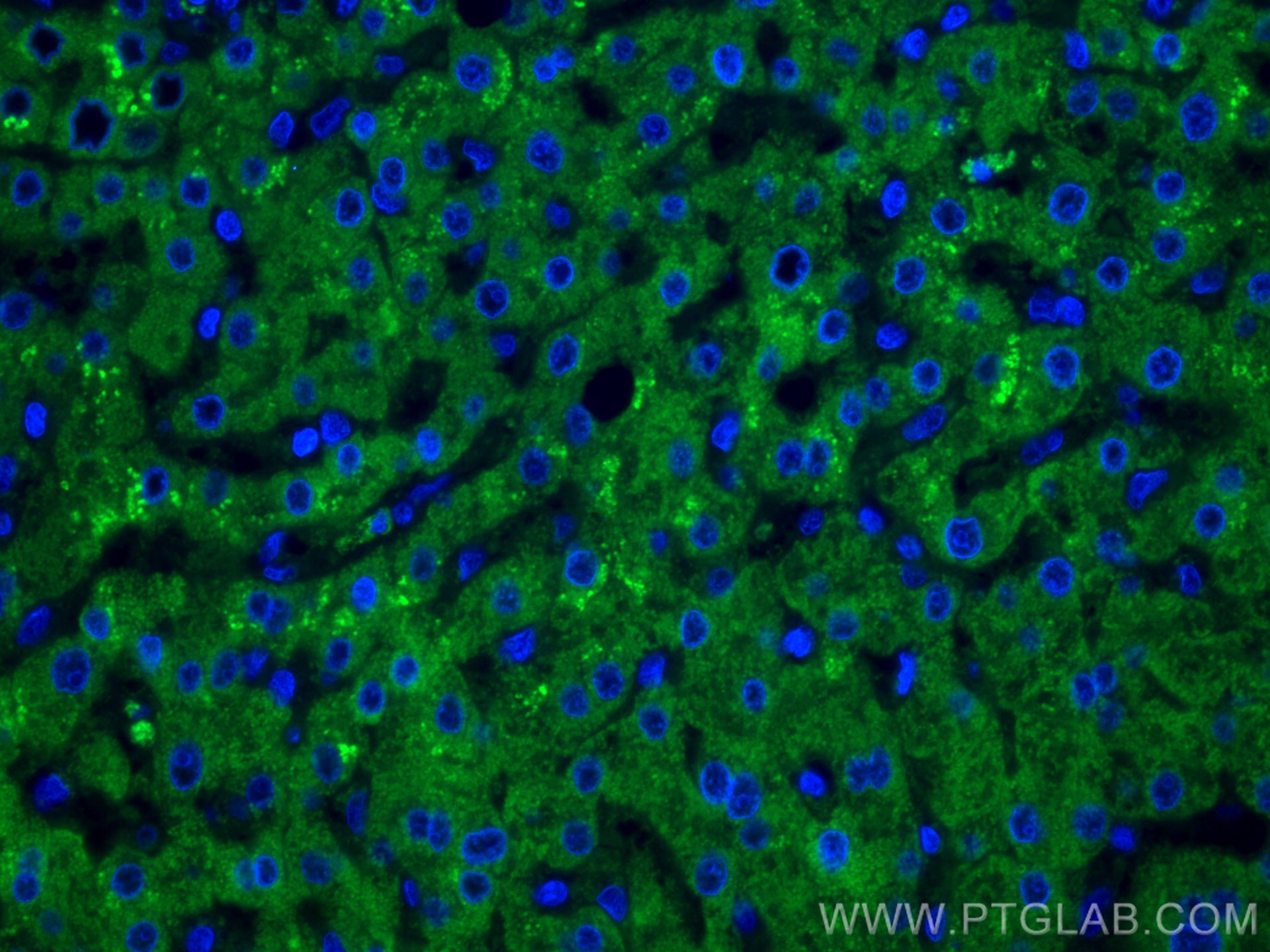 IF Staining of human liver cancer using CL488-67216