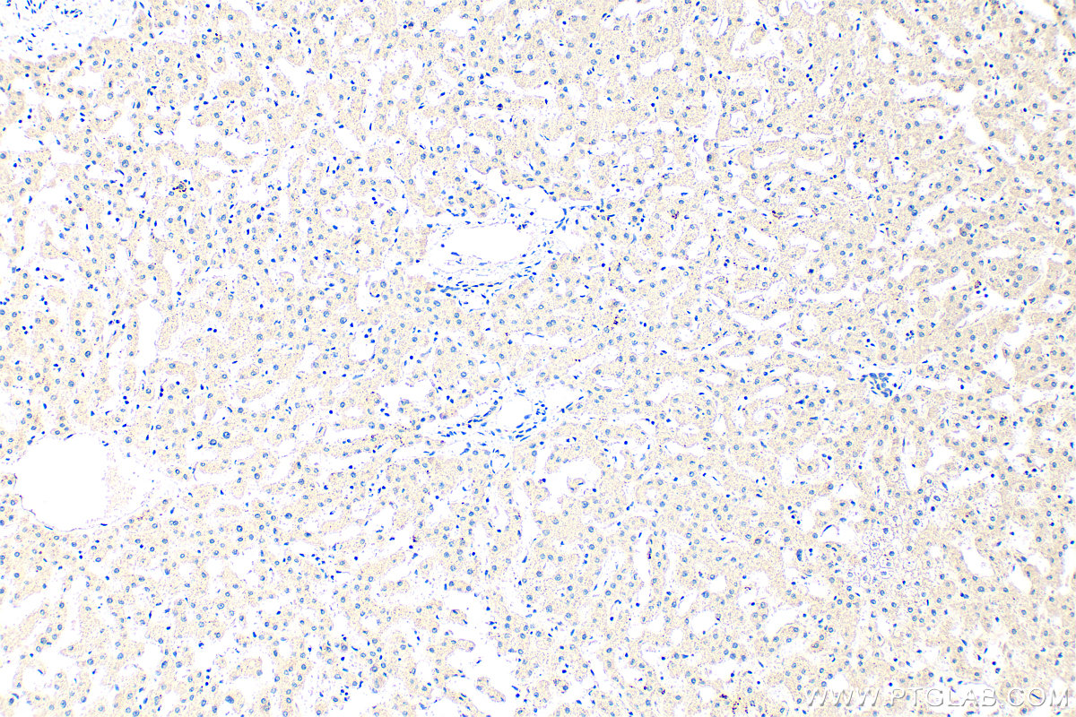 IHC staining of human liver using 12601-1-AP