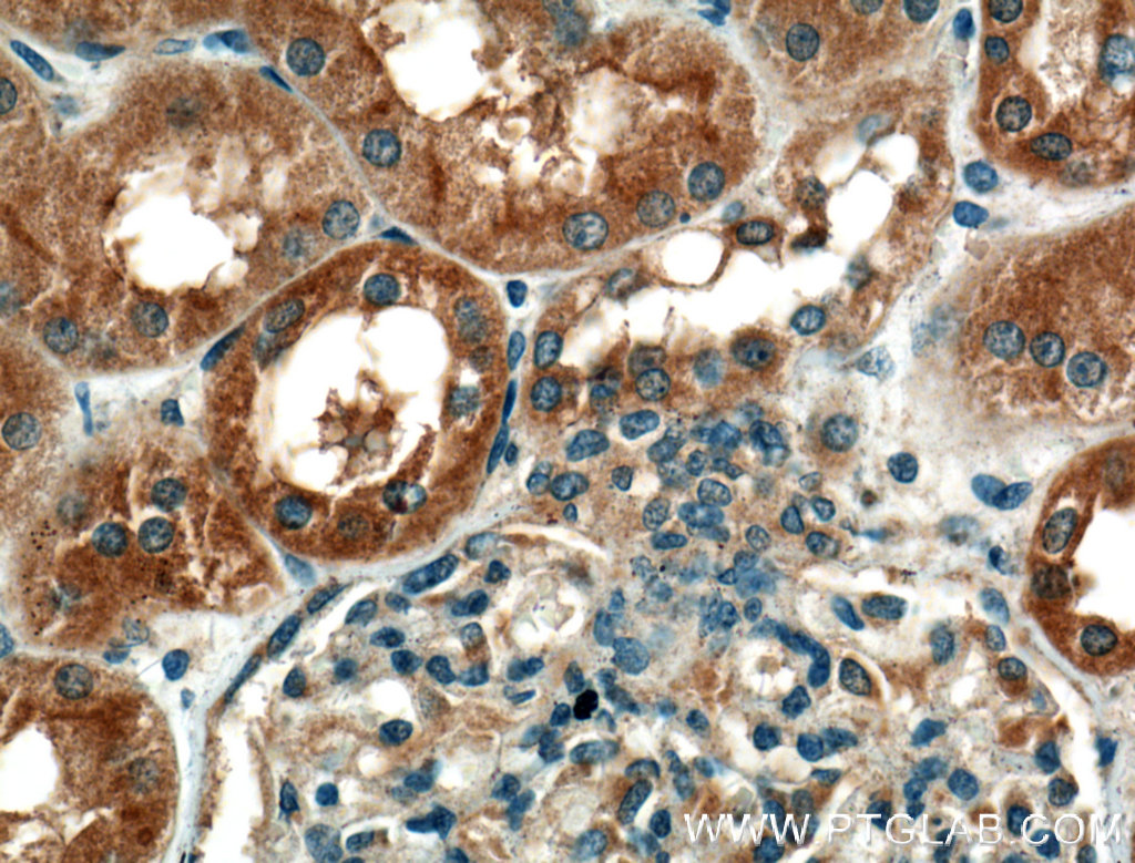 IHC staining of human kidney using 12601-1-AP