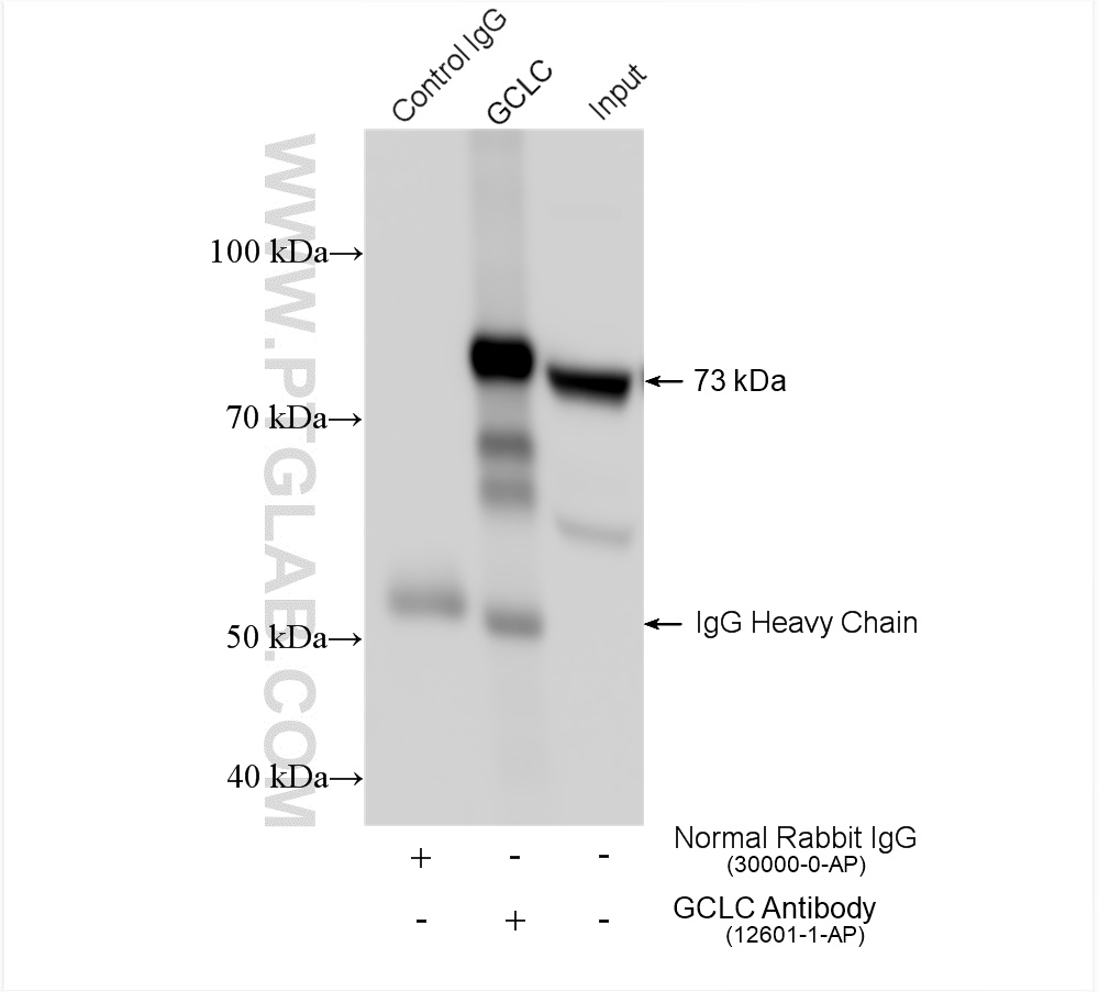 IP experiment of mouse kidney using 12601-1-AP