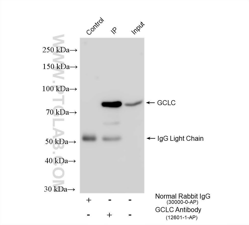 IP experiment of mouse kidney using 12601-1-AP