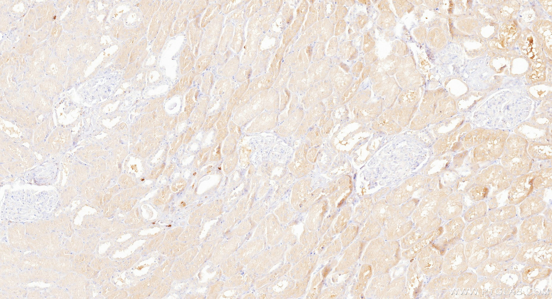 IHC staining of human kidney using 88062-1-RR
