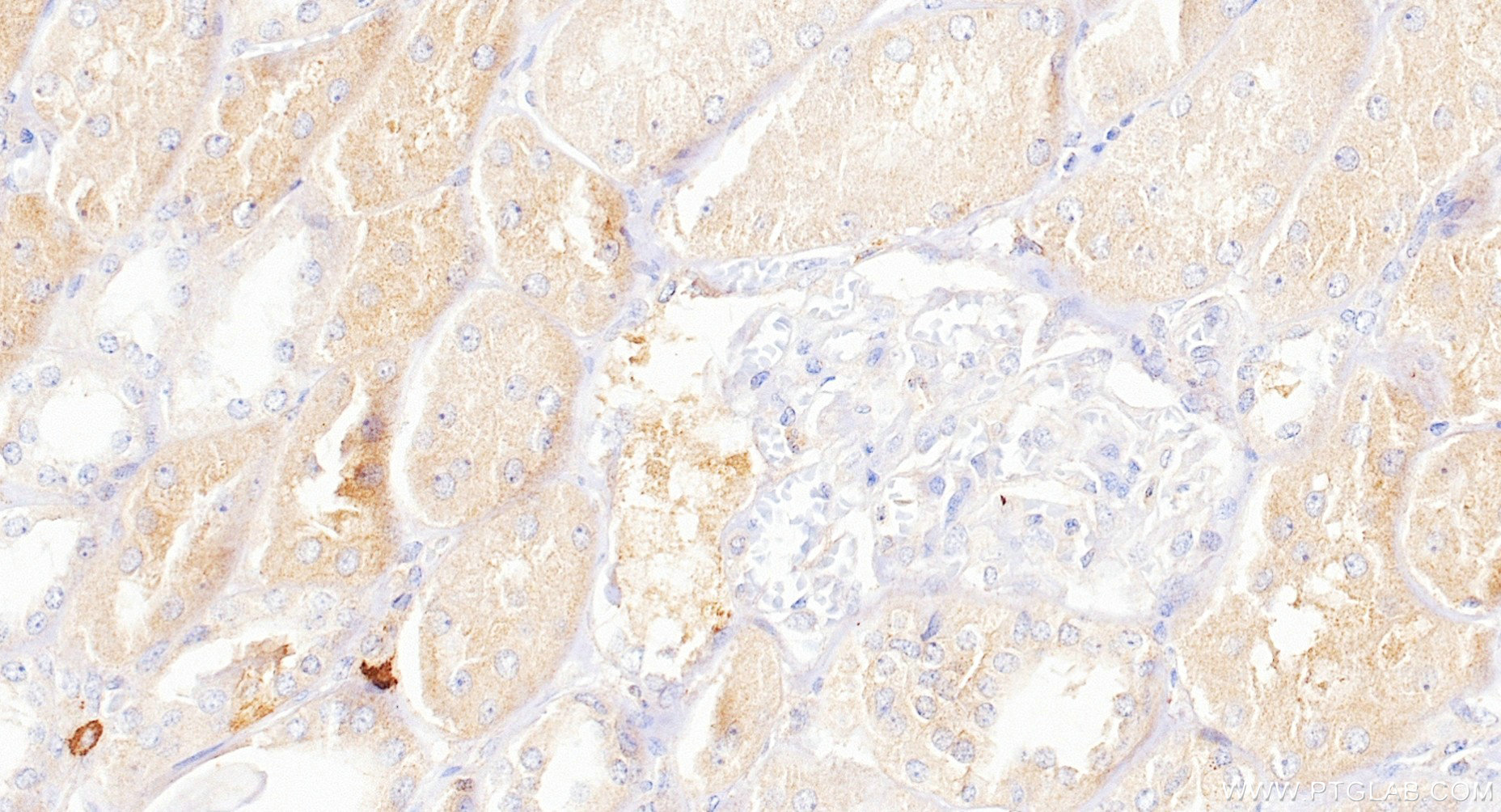 IHC staining of human kidney using 88062-1-RR