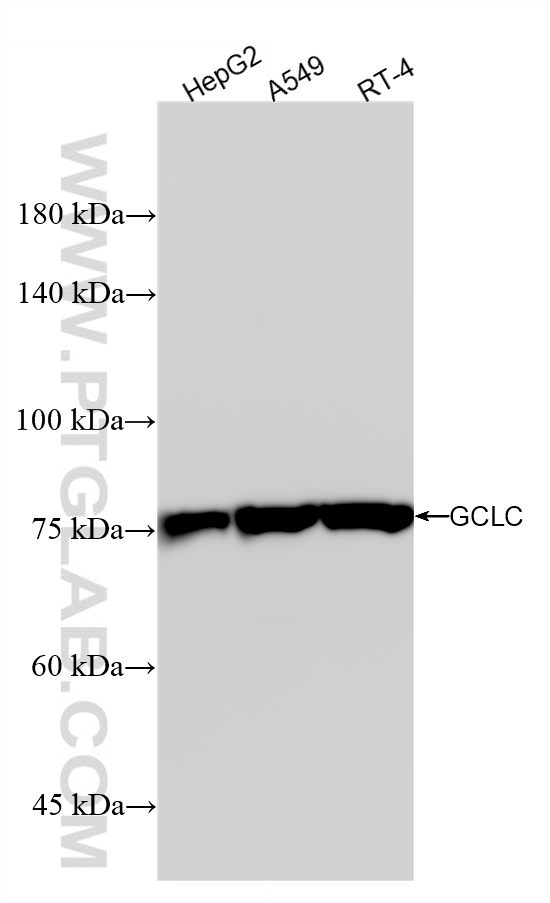 WB analysis using 88062-1-RR