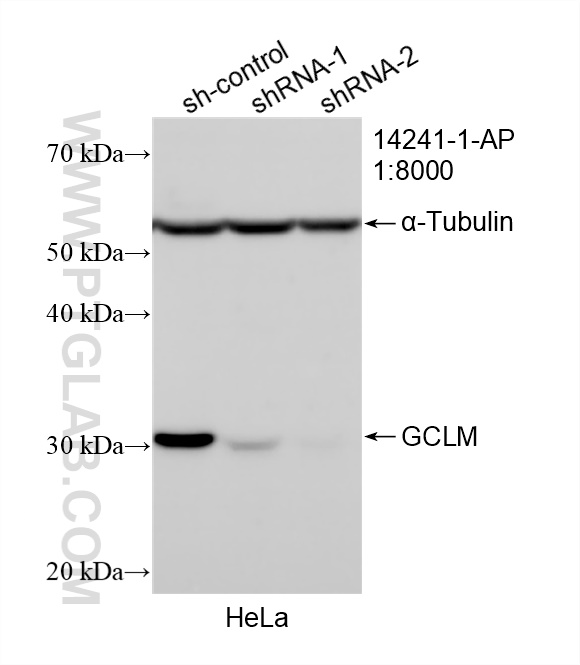 WB analysis of HeLa using 14241-1-AP