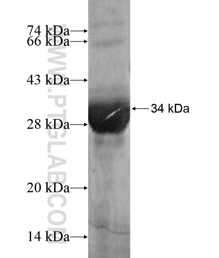 GCM1 fusion protein Ag17159 SDS-PAGE GCM1 fusion protein Ag17159 SDS-PAGE