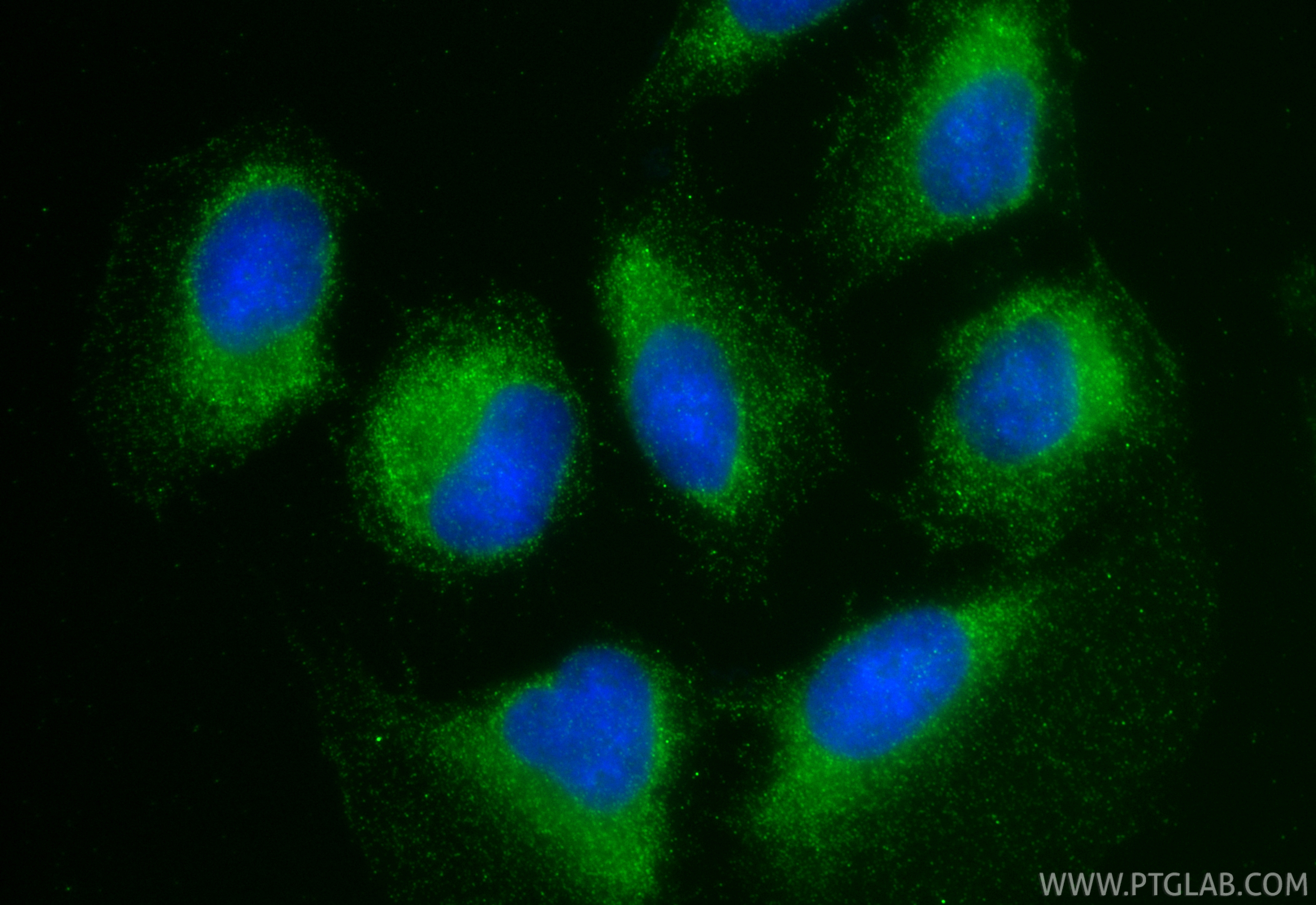 IF Staining of U2OS using 30993-1-AP IF Staining of U2OS using 30993-1-AP