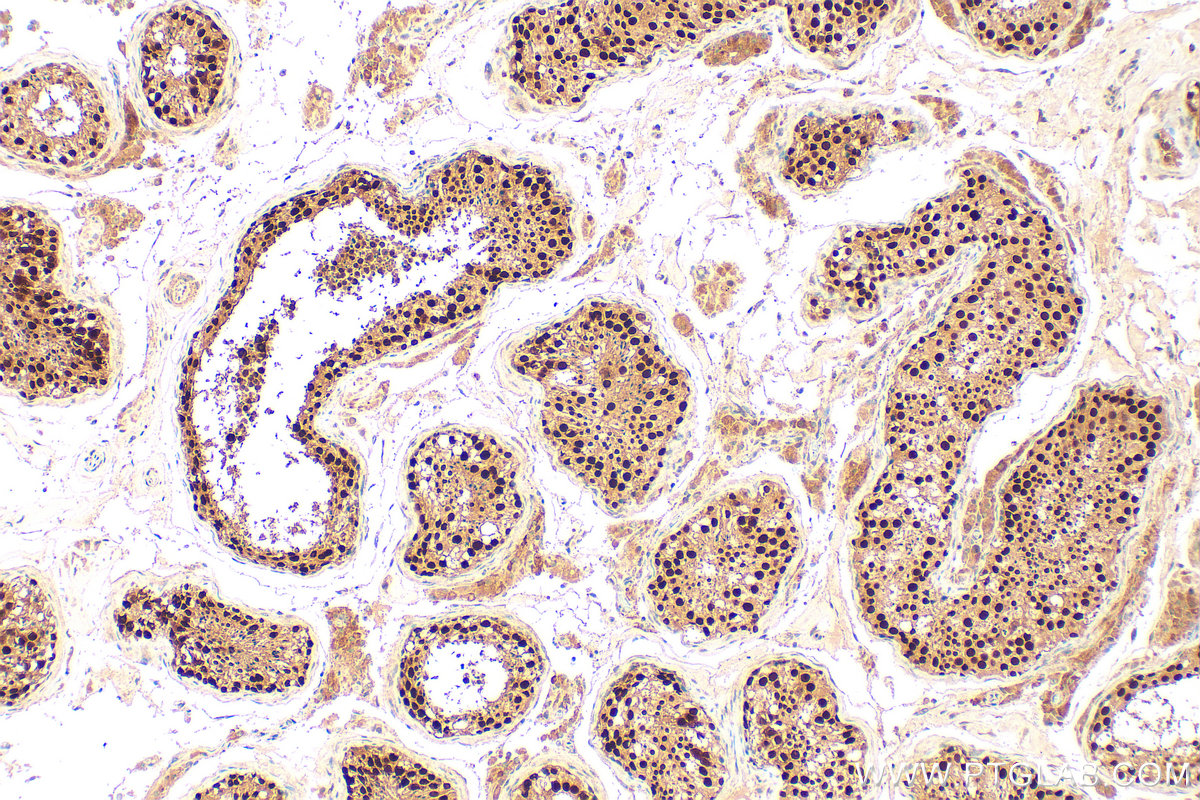 IHC staining of human testis using 30693-1-AP