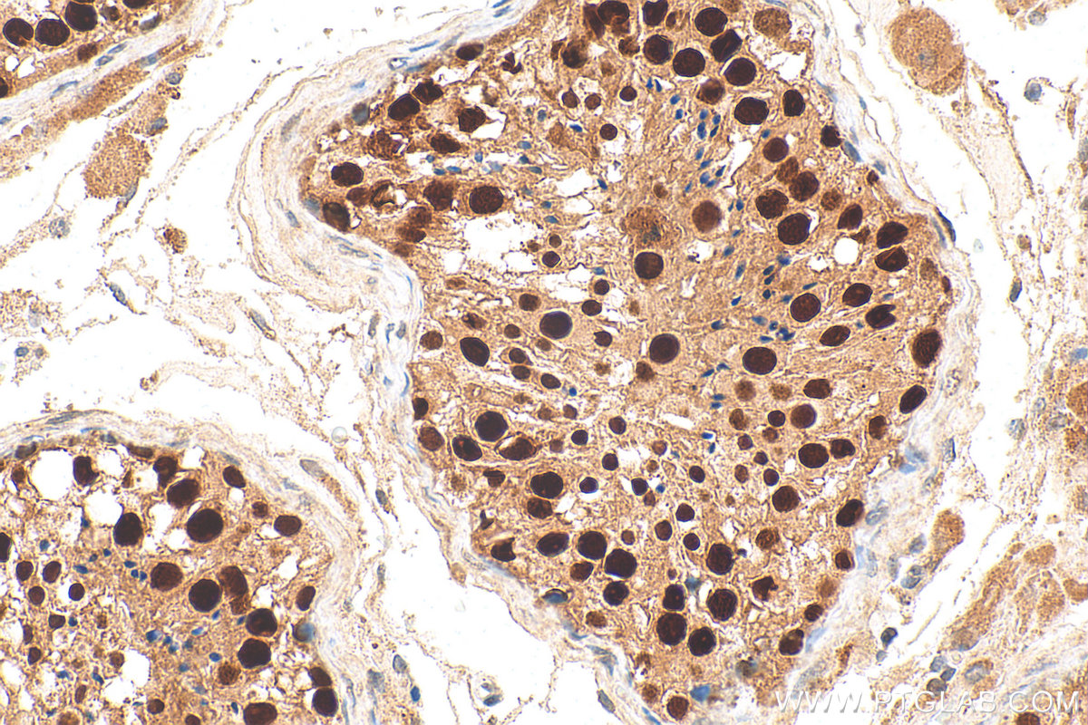 IHC staining of human testis using 30693-1-AP