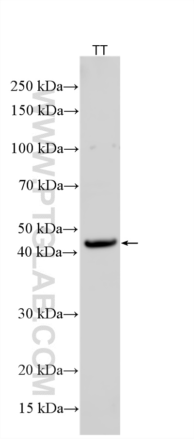 WB analysis using 17845-1-AP