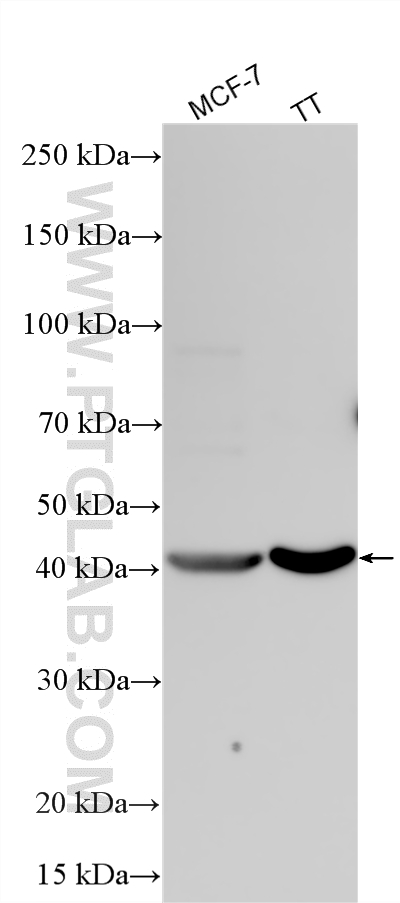 WB analysis using 17845-1-AP