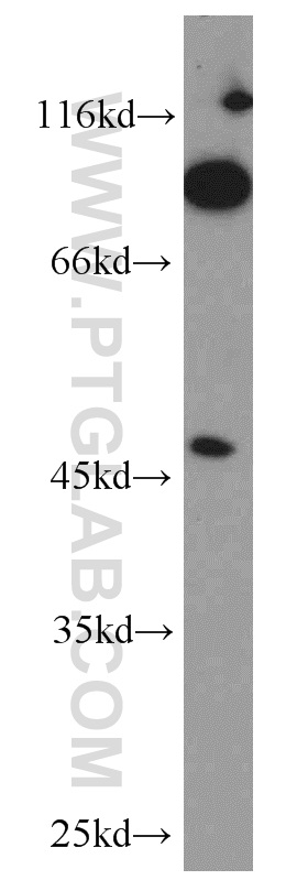 WB analysis of mouse kidney using 18118-1-AP