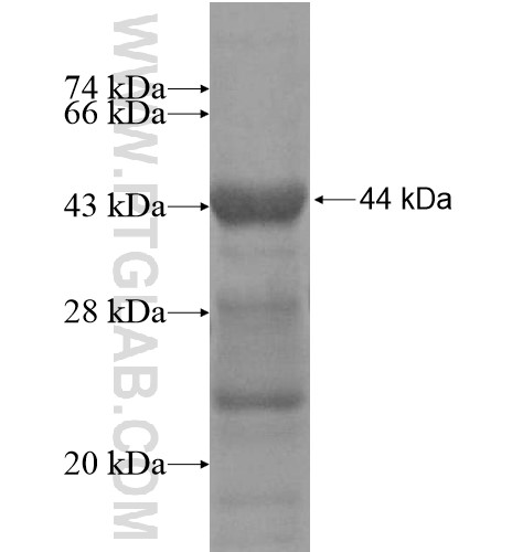 GCOM1 fusion protein Ag12515 SDS-PAGE GCOM1 fusion protein Ag12515 SDS-PAGE