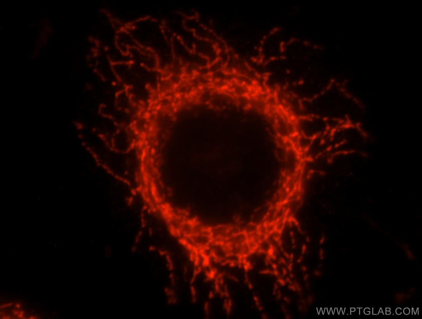 IF Staining of MCF-7 using 16726-1-AP